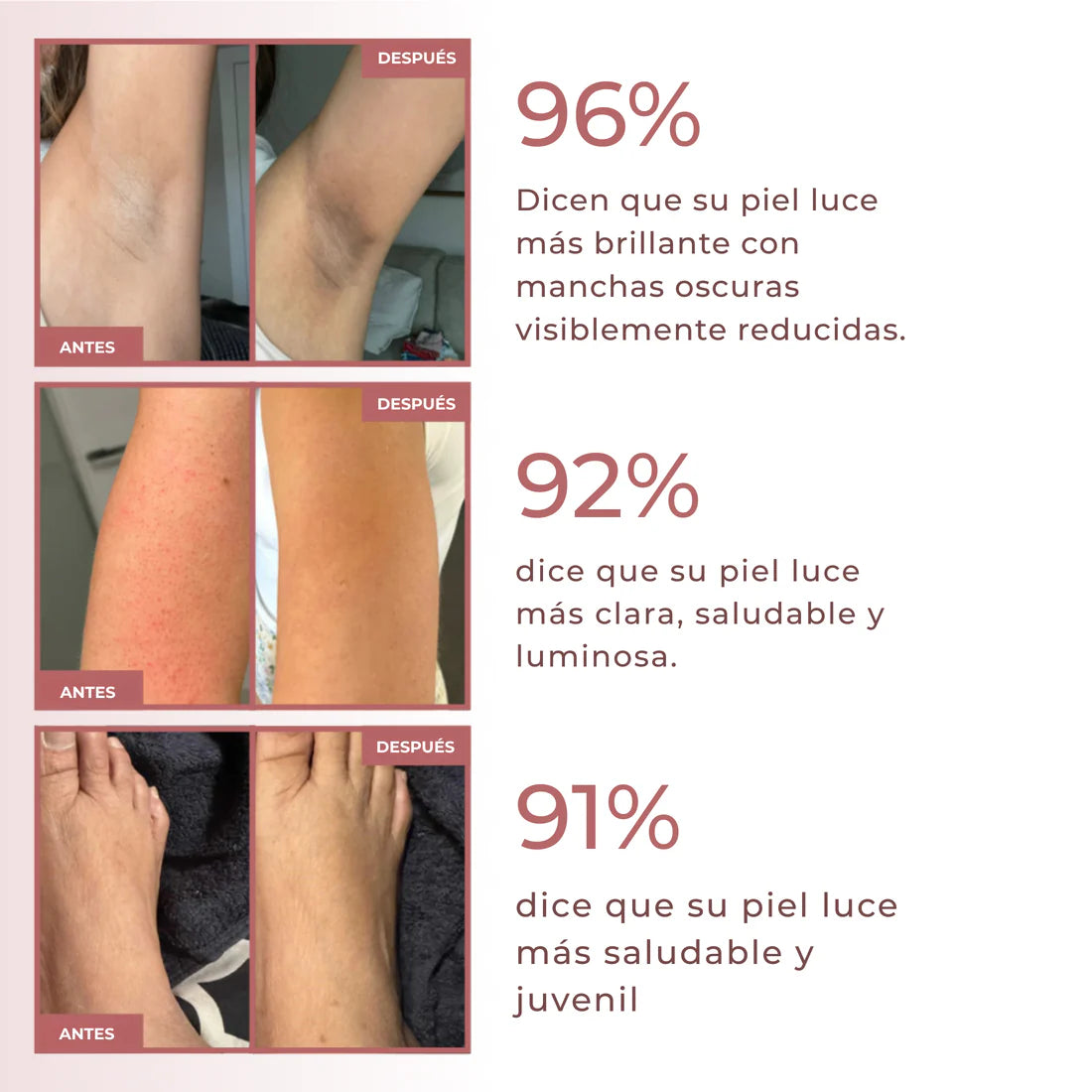 2x1 Spray Exfoliante corporal - Kójico + Curcuma